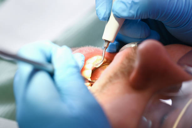 Best Emergency Treatment for Oral Infections in Pen Argyl, PA