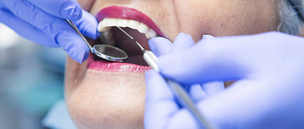 Best Broken or Chipped Tooth Repair in Pen Argyl, PA